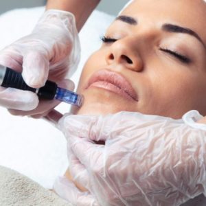 Limpieza Hidro Nutricion con Dermapen